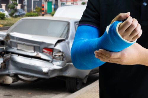 Verkehrsunfall – Schmerzensgeld bei Speichentrümmerfraktur