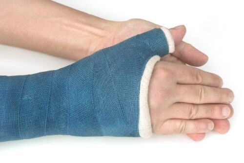 Verkehrsunfall - Schmerzensgeldanspruch bei Kahnbeinfraktur an rechter Hand