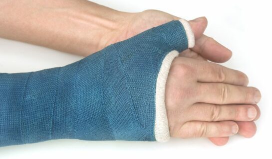 Verkehrsunfall – Schmerzensgeldanspruch bei Kahnbeinfraktur an rechter Hand